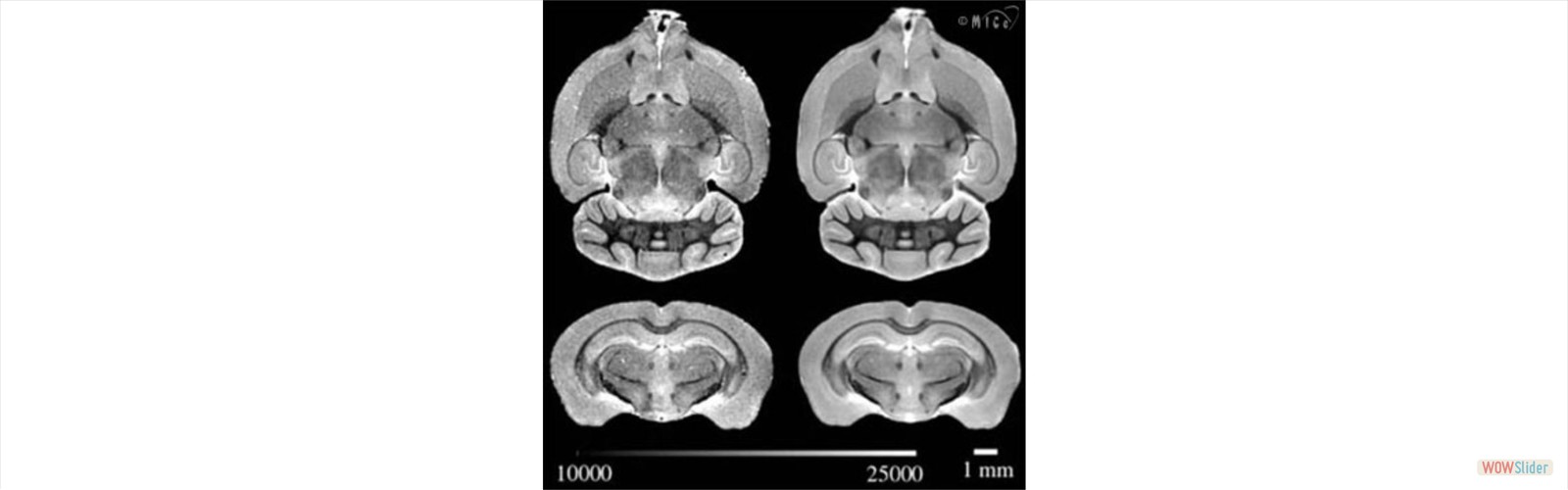 Mouse Brain MRI
