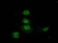 Localization of α-crystallin in cell upon heat shock